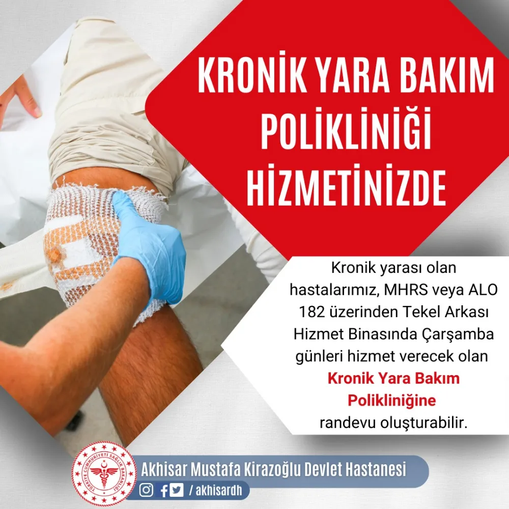 KRONİK YARA BAKIM POLİKLİNİĞİ HİZMET VERMEYE BAŞLADI