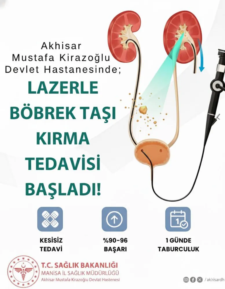 KİRAZOĞLU DEVLET HASTANESİNDE LAZERLE BÖBREK TAŞI TEDAVİSİ BAŞLADI