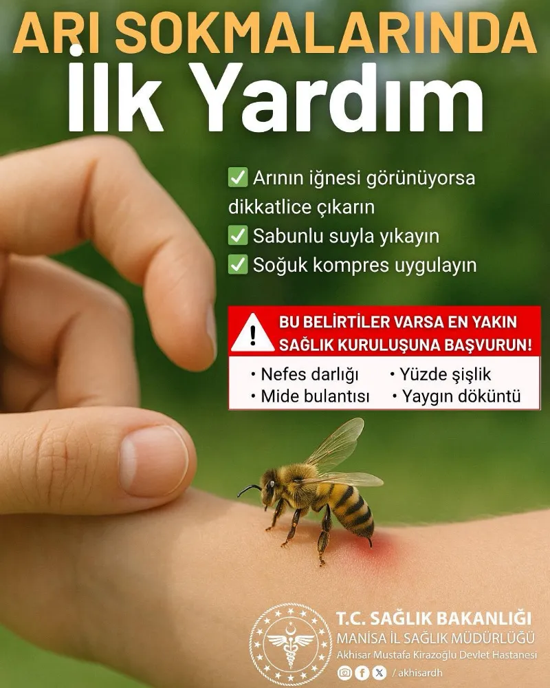 KİRAZOĞLU DEVLET HASTANESİ’NDEN ARI SOKMALARINA KARŞI HAYATİ UYARILAR